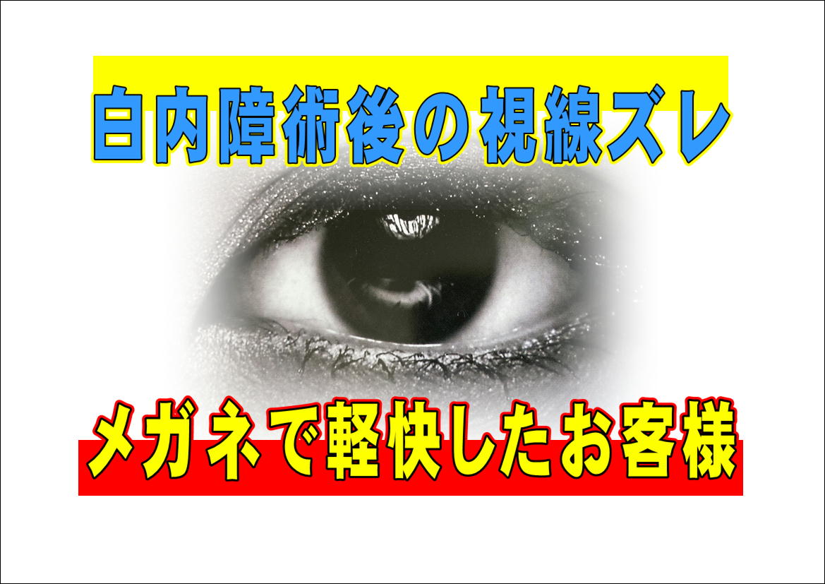 白内障の手術後に「ブレて見える」「ズレて見える」方がおられます。
